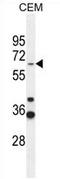 Zinc finger protein 667 antibody, AP54708PU-N, Origene, Western Blot image 