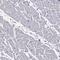 Junctional Sarcoplasmic Reticulum Protein 1 antibody, HPA044741, Atlas Antibodies, Immunohistochemistry frozen image 