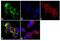 c-met antibody, 18-7366, Invitrogen Antibodies, Immunofluorescence image 