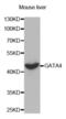 GATA Binding Protein 4 antibody, abx002601, Abbexa, Western Blot image 