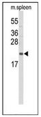 Interleukin 31 antibody, AP52198PU-N, Origene, Western Blot image 