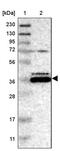 Zinc Finger And BTB Domain Containing 24 antibody, PA5-54111, Invitrogen Antibodies, Western Blot image 