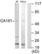 Zinc Finger HIT-Type Containing 6 antibody, PA5-39557, Invitrogen Antibodies, Western Blot image 