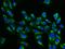 DEAD-Box Helicase 49 antibody, 202465-T02, Sino Biological, Immunohistochemistry paraffin image 