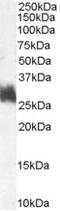 FOS Like 1, AP-1 Transcription Factor Subunit antibody, EB07279, Everest Biotech, Western Blot image 