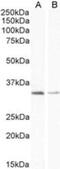 Uncoupling Protein 1 antibody, NB100-2828, Novus Biologicals, Western Blot image 