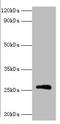 Rabies virus Matrix protein  antibody, A54616-100, Epigentek, Western Blot image 