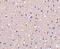 Dihydropyrimidinase-related protein 1 antibody, 3625, ProSci, Immunohistochemistry paraffin image 