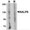 NLR Family Pyrin Domain Containing 6 antibody, TA320131, Origene, Western Blot image 