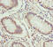 Electron transfer flavoprotein subunit alpha, mitochondrial antibody, LS-C675728, Lifespan Biosciences, Immunohistochemistry paraffin image 