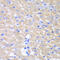Glycerol-3-Phosphate Acyltransferase, Mitochondrial antibody, 22-348, ProSci, Immunohistochemistry paraffin image 
