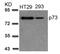 Tumor Protein P73 antibody, 79-527, ProSci, Western Blot image 