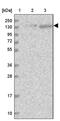 U2 SnRNP Associated SURP Domain Containing antibody, PA5-57997, Invitrogen Antibodies, Western Blot image 