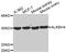 Probable alpha-ketoglutarate-dependent dioxygenase ABH4 antibody, MBS127750, MyBioSource, Western Blot image 