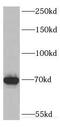 DEAH-Box Helicase 35 antibody, FNab02379, FineTest, Western Blot image 
