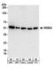 RNA Binding Motif Protein 22 antibody, A303-923A, Bethyl Labs, Western Blot image 