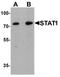 Signal Transducer And Activator Of Transcription 1 antibody, LS-C201036, Lifespan Biosciences, Western Blot image 