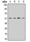 Dolichyl-diphosphooligosaccharide--protein glycosyltransferase 48 kDa subunit antibody, orb412841, Biorbyt, Western Blot image 