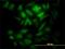 Kinetochore-associated protein 1 antibody, H00009735-M01, Novus Biologicals, Immunocytochemistry image 