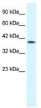 Purinergic Receptor P2X 2 antibody, TA338577, Origene, Western Blot image 