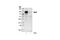 Signal Transducer And Activator Of Transcription 1 antibody, 9176S, Cell Signaling Technology, Immunoprecipitation image 