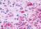 Luteinizing hormone receptor antibody, NLS1436, Novus Biologicals, Immunohistochemistry frozen image 
