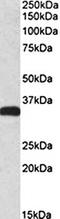 Carbonyl Reductase 3 antibody, orb18663, Biorbyt, Western Blot image 