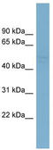 SET And MYND Domain Containing 2 antibody, TA346708, Origene, Western Blot image 