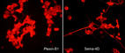 Semaphorin 4D antibody, SM1881, ECM Biosciences, Immunocytochemistry image 