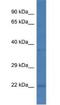 PEST Proteolytic Signal Containing Nuclear Protein antibody, NBP1-79669, Novus Biologicals, Western Blot image 