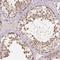 Chromosome 10 Open Reading Frame 67 antibody, HPA038131, Atlas Antibodies, Immunohistochemistry paraffin image 