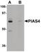 Protein Inhibitor Of Activated STAT 4 antibody, PA5-20954, Invitrogen Antibodies, Western Blot image 