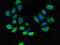 PLXND1 antibody, LS-C679077, Lifespan Biosciences, Immunofluorescence image 