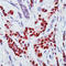 Estrogen Receptor 1 antibody, LS-C88420, Lifespan Biosciences, Immunohistochemistry frozen image 