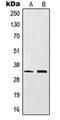 CD20 antibody, orb213690, Biorbyt, Western Blot image 