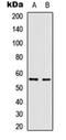 Vimentin antibody, orb304659, Biorbyt, Western Blot image 