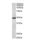 Potassium Voltage-Gated Channel Subfamily J Member 6 antibody, NB100-74575, Novus Biologicals, Western Blot image 