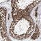 Cilia And Flagella Associated Protein 46 antibody, NBP2-48697, Novus Biologicals, Immunohistochemistry paraffin image 