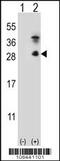 Kallikrein-7 antibody, 62-249, ProSci, Western Blot image 