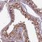 Chromosome 3 Open Reading Frame 70 antibody, HPA041861, Atlas Antibodies, Immunohistochemistry frozen image 