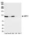 Ubiquitin Specific Peptidase 11 antibody, A301-613A, Bethyl Labs, Western Blot image 