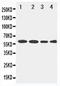 Lecithin-Cholesterol Acyltransferase antibody, PA1967, Boster Biological Technology, Western Blot image 