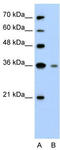 Granzyme H antibody, TA329501, Origene, Western Blot image 