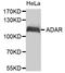 Double-stranded RNA-specific adenosine deaminase antibody, MBS129916, MyBioSource, Western Blot image 
