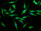 Leucine Rich Repeat Containing 45 antibody, LS-C674696, Lifespan Biosciences, Immunofluorescence image 