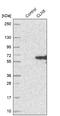 Ceroid-lipofuscinosis neuronal protein 5 antibody, NBP1-94150, Novus Biologicals, Western Blot image 
