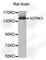 Neurotrophic Receptor Tyrosine Kinase 1 antibody, A0072, ABclonal Technology, Western Blot image 