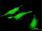 Ribonucleotide Reductase Regulatory TP53 Inducible Subunit M2B antibody, H00050484-M01, Novus Biologicals, Immunocytochemistry image 
