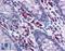 Ig lambda-1 chain C regions antibody, LS-B2657, Lifespan Biosciences, Immunohistochemistry paraffin image 