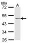 C-C Motif Chemokine Ligand 1 antibody, orb74033, Biorbyt, Western Blot image 